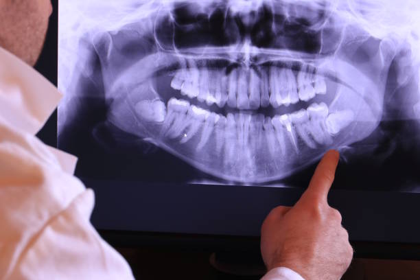 Best Knocked-Out Tooth Emergency  in Keego Harbor, MI